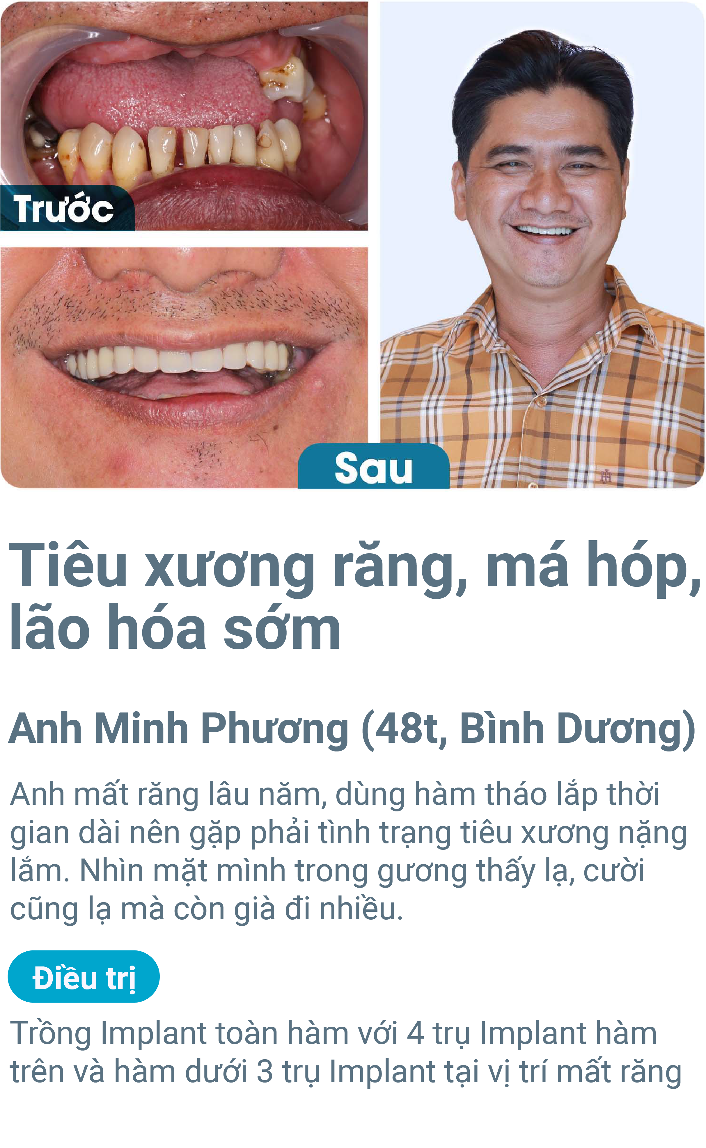 Trường hợp