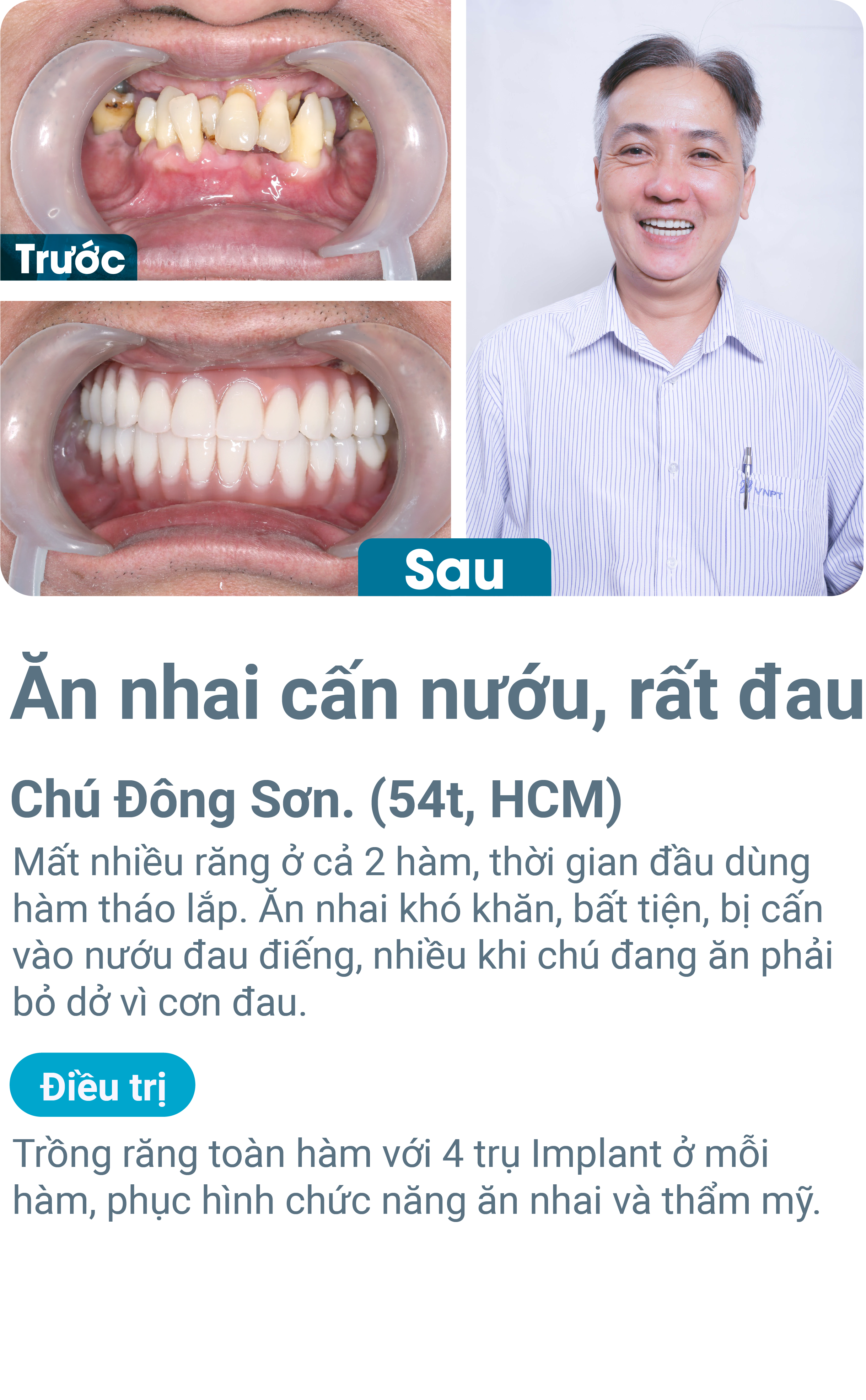 Trường hợp